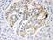 ISG15 Ubiquitin Like Modifier antibody, PB9950, Boster Biological Technology, Immunohistochemistry paraffin image 