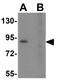 Toll Like Receptor 6 antibody, GTX85075, GeneTex, Western Blot image 