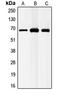 Gamma-Aminobutyric Acid Type A Receptor Beta1 Subunit antibody, LS-C352228, Lifespan Biosciences, Western Blot image 