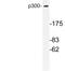 EP300 antibody, LS-C176507, Lifespan Biosciences, Western Blot image 