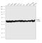 Tubulin Beta 8 Class VIII antibody, PA5-22045, Invitrogen Antibodies, Western Blot image 