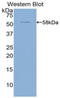 Activated Leukocyte Cell Adhesion Molecule antibody, LS-C292356, Lifespan Biosciences, Western Blot image 