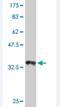 Solute Carrier Family 1 Member 6 antibody, H00006511-M01, Novus Biologicals, Western Blot image 