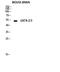 GATA Binding Protein 3 antibody, STJ93225, St John
