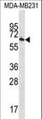 Guanylate Binding Protein 1 antibody, LS-C166396, Lifespan Biosciences, Western Blot image 