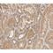 Heat Shock Protein Family B (Small) Member 1 antibody, GTX17677, GeneTex, Immunohistochemistry paraffin image 