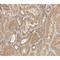 Heat Shock Protein Family B (Small) Member 1 antibody, GTX17677, GeneTex, Immunohistochemistry paraffin image 