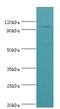 Adaptor Related Protein Complex 2 Subunit Beta 1 antibody, MBS1499998, MyBioSource, Western Blot image 