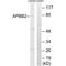 Amyloid Beta Precursor Protein Binding Family B Member 2 antibody, PA5-49975, Invitrogen Antibodies, Western Blot image 
