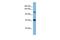 Myosin 1E antibody, GTX45049, GeneTex, Western Blot image 