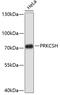 Protein Kinase C Substrate 80K-H antibody, 19-255, ProSci, Western Blot image 