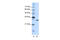 Goosecoid Homeobox 2 antibody, 28-903, ProSci, Western Blot image 