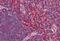 C-X-C Motif Chemokine Receptor 6 antibody, MBS242091, MyBioSource, Immunohistochemistry frozen image 