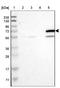 Cytochrome P450 Family 4 Subfamily F Member 11 antibody, NBP1-87461, Novus Biologicals, Western Blot image 