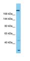 Spectrin Alpha, Erythrocytic 1 antibody, orb327198, Biorbyt, Western Blot image 