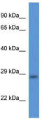 Transmembrane Protein 33 antibody, TA342358, Origene, Western Blot image 