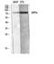 Dipeptidyl Peptidase 4 antibody, STJ97660, St John