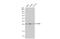 Eukaryotic Translation Initiation Factor 6 antibody, GTX117971, GeneTex, Western Blot image 