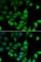 RNA Polymerase II Subunit H antibody, LS-C748392, Lifespan Biosciences, Immunofluorescence image 