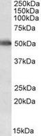 Cytochrome P450 Family 2 Subfamily E Member 1 antibody, LS-B8344, Lifespan Biosciences, Western Blot image 