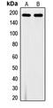 Fms Related Tyrosine Kinase 1 antibody, MBS820675, MyBioSource, Western Blot image 