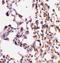 BH3 Interacting Domain Death Agonist antibody, A00730-1, Boster Biological Technology, Immunohistochemistry paraffin image 