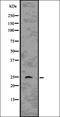 Ras Homolog Family Member Q antibody, orb336712, Biorbyt, Western Blot image 