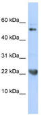 TNF Superfamily Member 12 antibody, TA341640, Origene, Western Blot image 