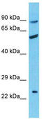 Blood group Rh(CE) polypeptide antibody, TA344173, Origene, Western Blot image 