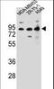 CTTNBP2 N-Terminal Like antibody, LS-C167151, Lifespan Biosciences, Western Blot image 