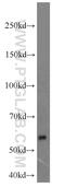 Mannosyl (Alpha-1,3-)-Glycoprotein Beta-1,2-N-Acetylglucosaminyltransferase antibody, 15103-1-AP, Proteintech Group, Western Blot image 