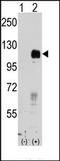 EPH Receptor B4 antibody, AP14301PU-N, Origene, Western Blot image 
