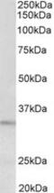 Peptidase Inhibitor 15 antibody, MBS422673, MyBioSource, Western Blot image 