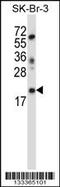 Lin-52 DREAM MuvB Core Complex Component antibody, 57-071, ProSci, Western Blot image 