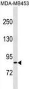 Tgr antibody, abx031109, Abbexa, Western Blot image 