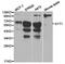 Synaptotagmin 1 antibody, TA326884, Origene, Western Blot image 
