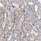 Nucleoporin 93 antibody, PA5-53674, Invitrogen Antibodies, Immunohistochemistry paraffin image 