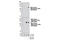 Malic Enzyme 2 antibody, 12399S, Cell Signaling Technology, Western Blot image 