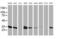 Lactamase Beta 2 antibody, MA5-25465, Invitrogen Antibodies, Western Blot image 