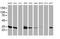 Lactamase Beta 2 antibody, MA5-25465, Invitrogen Antibodies, Western Blot image 