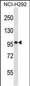 Dispatched RND Transporter Family Member 3 antibody, PA5-48733, Invitrogen Antibodies, Western Blot image 