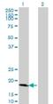 Cyclin Dependent Kinase Inhibitor 2D antibody, H00001032-M08, Novus Biologicals, Western Blot image 