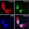 Heterogeneous Nuclear Ribonucleoprotein L antibody, orb76674, Biorbyt, Immunohistochemistry paraffin image 