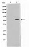 T-Box 22 antibody, TA347725, Origene, Western Blot image 