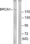 BRCA1 DNA Repair Associated antibody, LS-C118350, Lifespan Biosciences, Western Blot image 