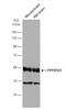PP2A subunit B isoform B55-delta antibody, NBP2-15081, Novus Biologicals, Western Blot image 
