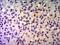 Tripartite Motif Containing 28 antibody, GTX49179, GeneTex, Immunohistochemistry paraffin image 