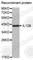 Interleukin 12B antibody, A1394, ABclonal Technology, Western Blot image 