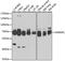 Heterogeneous Nuclear Ribonucleoprotein L antibody, A8430, ABclonal Technology, Western Blot image 