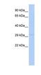 LY6/PLAUR Domain Containing 4 antibody, NBP1-58023, Novus Biologicals, Western Blot image 